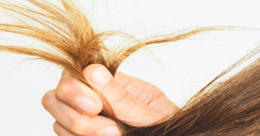 موخوره نیر در ریزش موی سر تاثیر دارد ،که میتوان آن را به راحتی درمان کرد