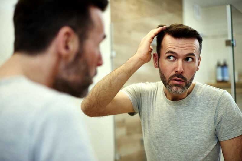 ریزش مو در مردان از زنان بیشتر است و ارثی و هورمون در آن نقش اصلی را دارد